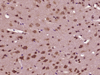 RPS6KC1 Rabbit Polyclonal Antibody