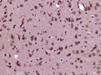 RRNAD1 Rabbit Polyclonal Antibody