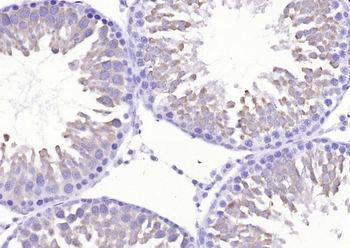 SRC Rabbit Polyclonal Antibody