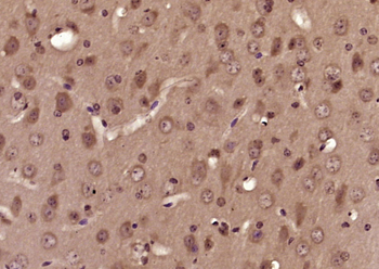 SOD1 Rabbit Polyclonal Antibody