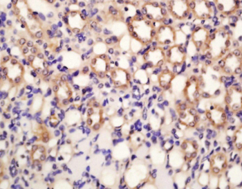 SOD1 Rabbit Polyclonal Antibody