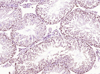 SCP3 Rabbit Polyclonal Antibody