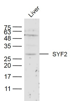 SYF2 Rabbit Polyclonal Antibody