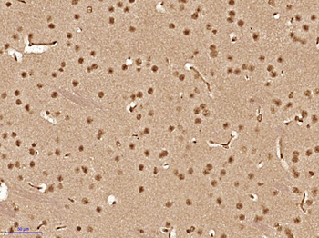 SCAND1 Rabbit Polyclonal Antibody