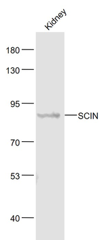 SCIN Rabbit Polyclonal Antibody