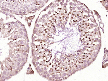 Phospho-IRF3 (Ser386) Rabbit Polyclonal Antibody