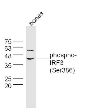 Phospho-IRF3 (Ser386) Rabbit Polyclonal Antibody