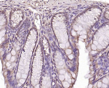SFRS3 Rabbit Polyclonal Antibody
