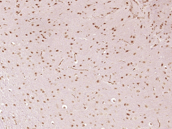 SFRS5 Rabbit Polyclonal Antibody