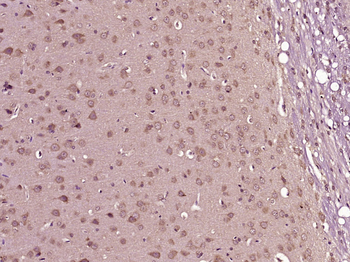 SGCE Rabbit Polyclonal Antibody