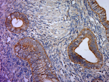 Shroom 3 Rabbit Polyclonal Antibody