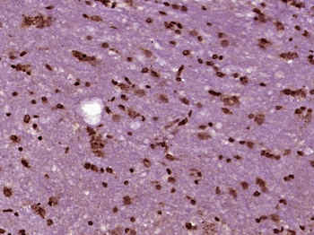 SKOR2 Rabbit Polyclonal Antibody