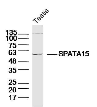 SPATA15/SPATC1 Rabbit Polyclonal Antibody
