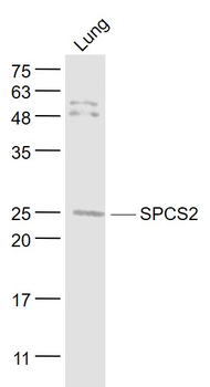 SPCS2 Rabbit Polyclonal Antibody