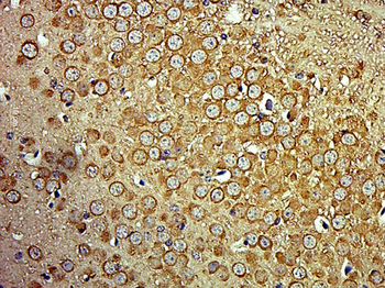 SPTBN3 Rabbit Polyclonal Antibody