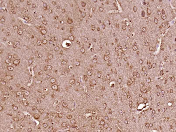SPIN4 Rabbit Polyclonal Antibody