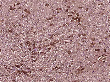 SARDH Rabbit Polyclonal Antibody