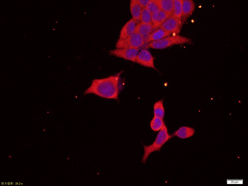 SEC61 beta Rabbit Polyclonal Antibody