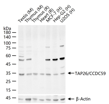 TAP26/CCDC59 Rabbit Polyclonal Antibody