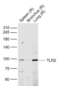 TLR2 Rabbit Polyclonal Antibody