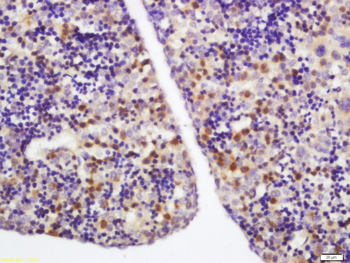 TLR2 Rabbit Polyclonal Antibody