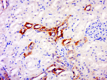 TRANK1 Rabbit Polyclonal Antibody