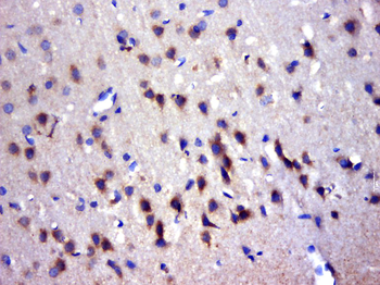 TRIM45 Rabbit Polyclonal Antibody