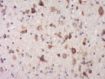 TRIM68 Rabbit Polyclonal Antibody