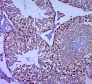 TRIML2 Rabbit Polyclonal Antibody