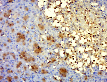 TRMT12 Rabbit Polyclonal Antibody