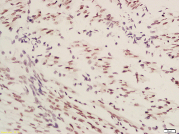 TRIOBP Rabbit Polyclonal Antibody