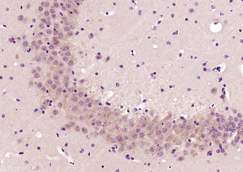 Tropomodulin 2 Rabbit Polyclonal Antibody