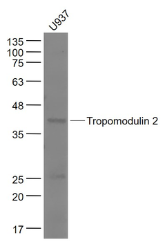 Tropomodulin 2 Rabbit Polyclonal Antibody
