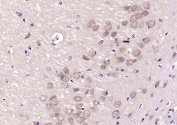 CAF1p55/VPRBP Rabbit Polyclonal Antibody