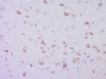 TPRG1 Rabbit Polyclonal Antibody