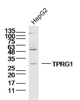 TPRG1 Rabbit Polyclonal Antibody