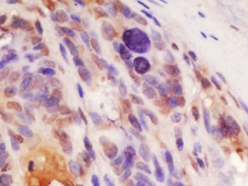 TOMM22 Rabbit Polyclonal Antibody