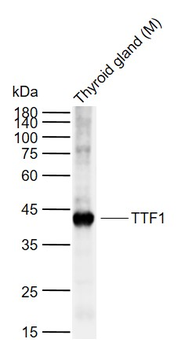 TTF1/NKX2-1 Rabbit Polyclonal Antibody