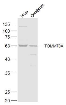 TOMM70A Rabbit Polyclonal Antibody