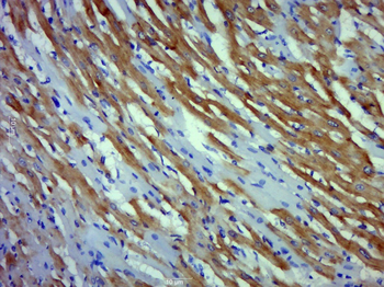 TNNI3 Rabbit Polyclonal Antibody