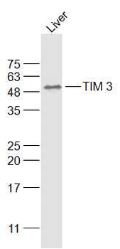 HAVCR2/TIM-3 Rabbit Polyclonal Antibody