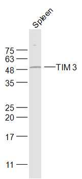 HAVCR2/TIM-3 Rabbit Polyclonal Antibody