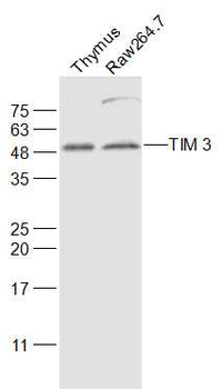 HAVCR2/TIM-3 Rabbit Polyclonal Antibody