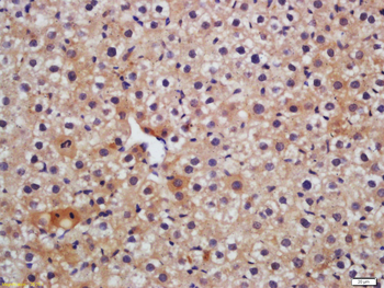 HAVCR2/TIM-3 Rabbit Polyclonal Antibody