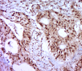 ZNF778 Rabbit Polyclonal Antibody