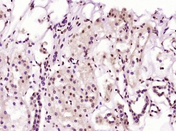 ZC3H11A Rabbit Polyclonal Antibody