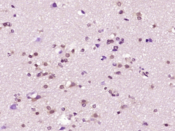 ZC3H7B Rabbit Polyclonal Antibody