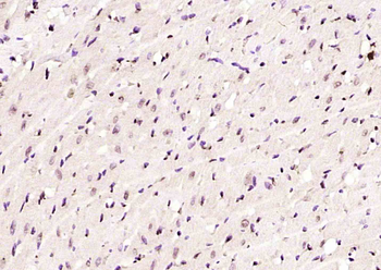 ZNF366 Rabbit Polyclonal Antibody