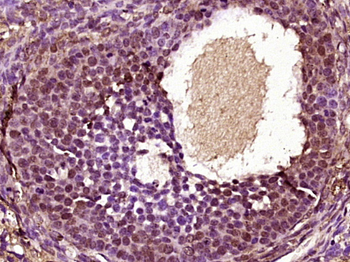 ZFP161 Rabbit Polyclonal Antibody