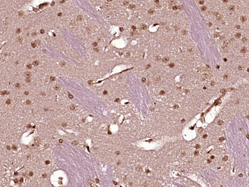 ZC3H8 Rabbit Polyclonal Antibody